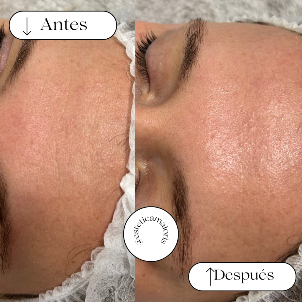 image11 High-quality Estetica in Mallorca