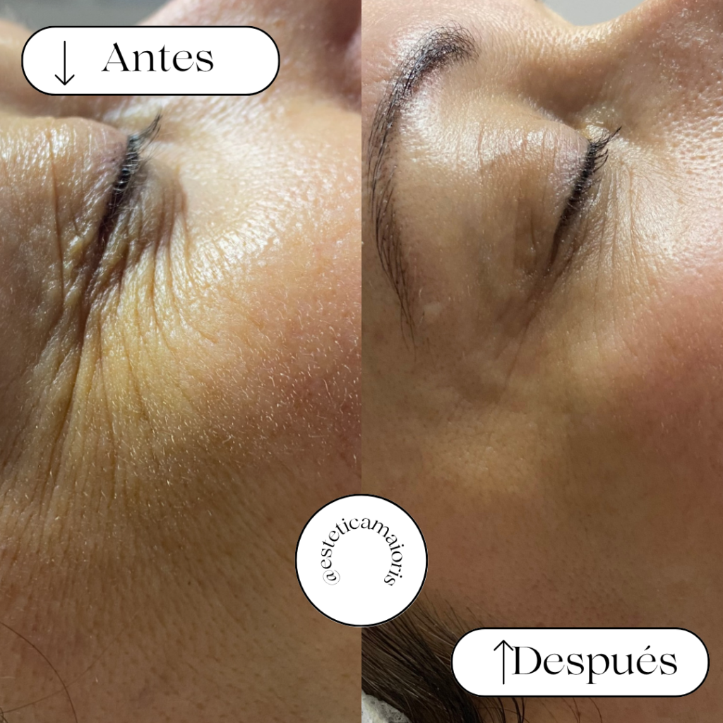 image13 High-quality Estetica in Mallorca